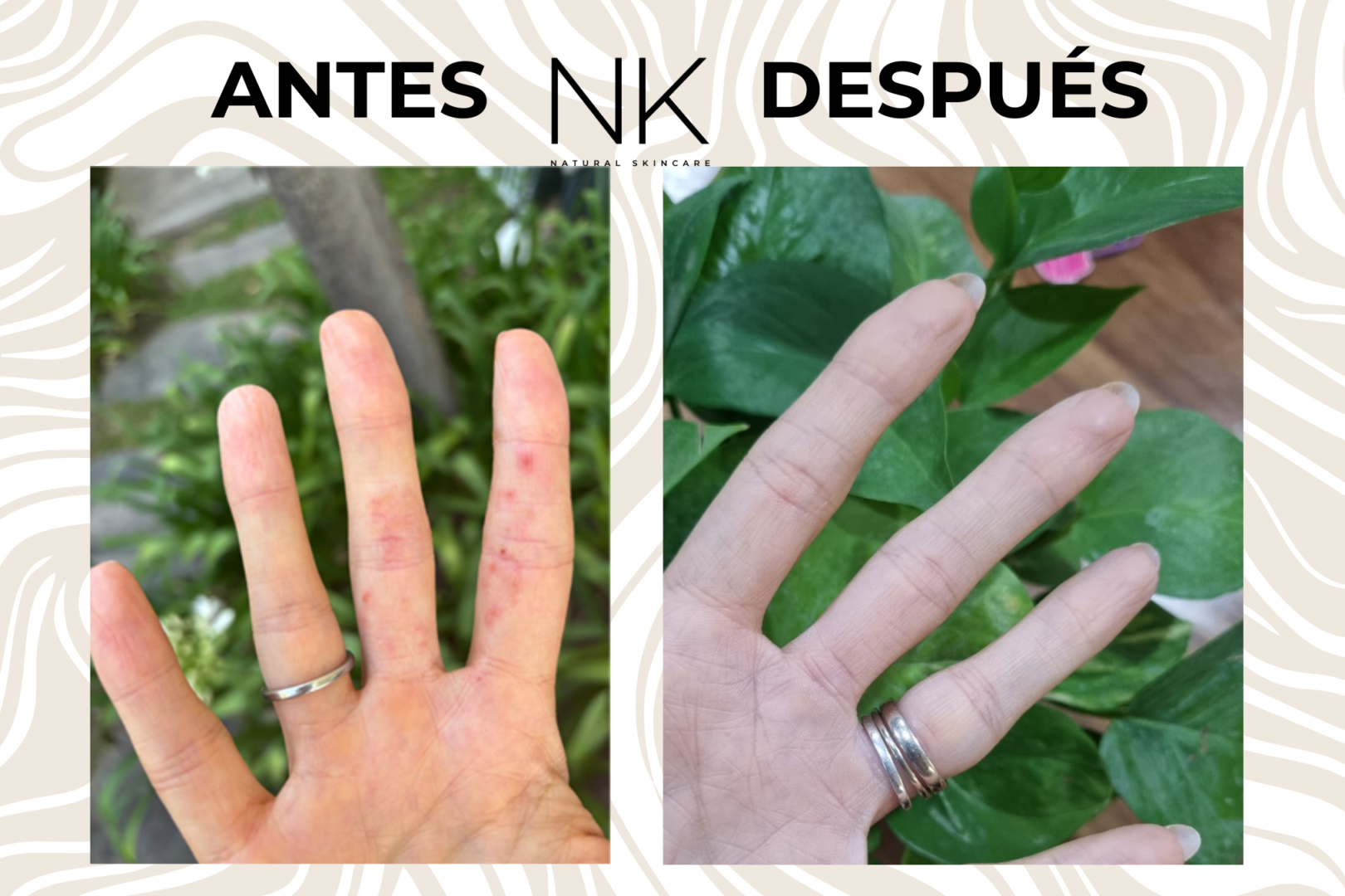 ANTES Y DESPUES2